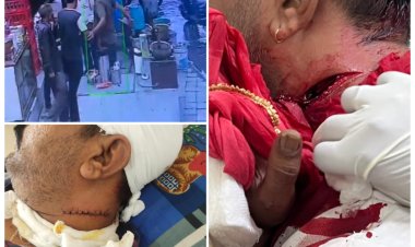 एमपी के इस जिले में पुलिस दे रही बदमाशों को संरक्षण, पीड़ित ने लगाई एसपी से गुहार,  जानलेवा हमले के बाद भी बदमाश पहुंचे पीड़ित के भाई को धमकाने,  सीसीटीवी में कैद हुई वारदात